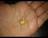 Foto del paso 2 de la receta: Brotes de lentejas