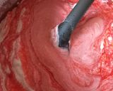 Une image de l'étape 8 de Glace à la fraise 🍓.