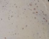 A picture of step 10 of Puran Poli.