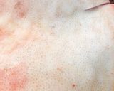 Hình bước làm 1 của món Vũ Điệu Dưới Nắng- Thịt Heo Một Nắng(Cách3)