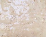 Foto del paso 2 de la receta: Pan de hamburguesas fácil y muy sabroso