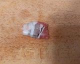 Baconbe göngyölt aszalt szilva falatkák recept fázis 2 fotója