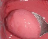Foto del paso 1 de la receta: Postre helado súper fácil