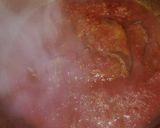 Foto del paso 2 de la receta: Spaghetti para uno