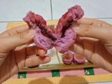 Donat Ubi Ungu dan Roti Teflon Ubi Ungu (Tanpa Telur)