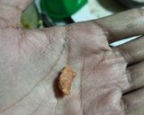 A picture of step 19 of Kacche Kele Ke Kofte.
