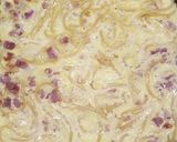 A picture of step 3 of Spaghetti frittata.