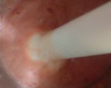 A picture of step 1 of Chana.