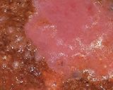 A picture of step 3 of Kathal sabzi.