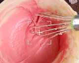 A picture of step 3 of Red marble cake.