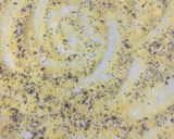 Foto del paso 5 de la receta: TARTA DE PAPA 🥔 VERDEOS Y RICOTTA🤩🤗🥰🎊