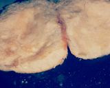 Foto del paso 13 de la receta: HU3RAz♡ Torta de Milanesa
