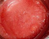 A picture of step 2 of Watermelon Sorbet.