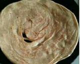 A picture of step 8 of Chur Chur paratha 😊😊😊.