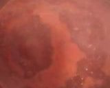 A picture of step 4 of Pomodoro Sauce.