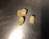 Une image de l'étape 2 de Gratin de navets blancs au stilton,ail et 4 épices.