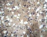 Foto del paso 8 de la receta: Skillet Cookie