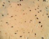 A picture of step 3 of Dal pakwan.