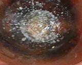 A picture of step 3 of Baingan Bharta (वांग्याचे भरीत).