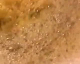Foto del paso 6 de la receta: Tortilla de calabacín blanco, sin más