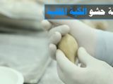 كبة مقلية (طريقتي)