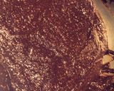 Une image de l'étape 3 de Galette des rois chocolat.