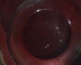 Foto del paso 4 de la receta: Glaseado espejo con chocolate semi-amargo