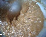 અડદિયા(Adadiya Recipe in Gujarati) રેસીપી સ્ટેપ8ફોટો