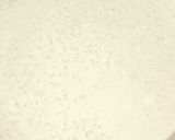 A picture of step 5 of Date Palm Jaggery Rice Kheer.