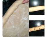 A picture of step 8 of Potato Puff Patties.
