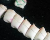 A picture of step 7 of Khoya malai khaja.