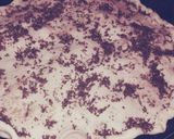 Foto del paso 10 de la receta: Tarta de atún dulzor
