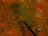 Moong dal palak