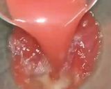 A picture of step 1 of Watermelon Jelly.
