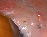 A picture of step 7 of Daal Mash.