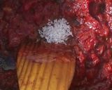 A picture of step 4 of Instant pizza sauce.