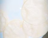 A picture of step 5 of Kachori with tarkari.