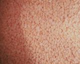 A picture of step 1 of Masoor dal.