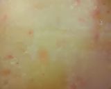 A picture of step 2 of Moong Dal Tadka.