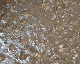 A picture of step 7 of Methi sukhdi.