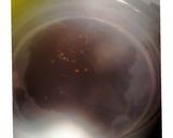 A picture of step 1 of میمنی مسور اکنی.