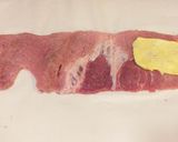 Foto del paso 1 de la receta: Caña de lomo rellena