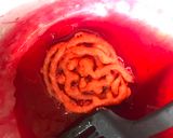 A picture of step 8 of Whosayna’s Gulaabi Jalebi.