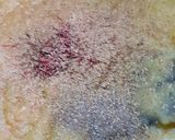 A picture of step 5 of Puran poli.