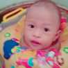 acil anty