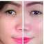NV Skincare