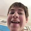 Jimmy Eschrich